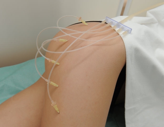 Озонотерапия - Оздоровительные услуги - Санаторий «Солнечный» Кисловодск